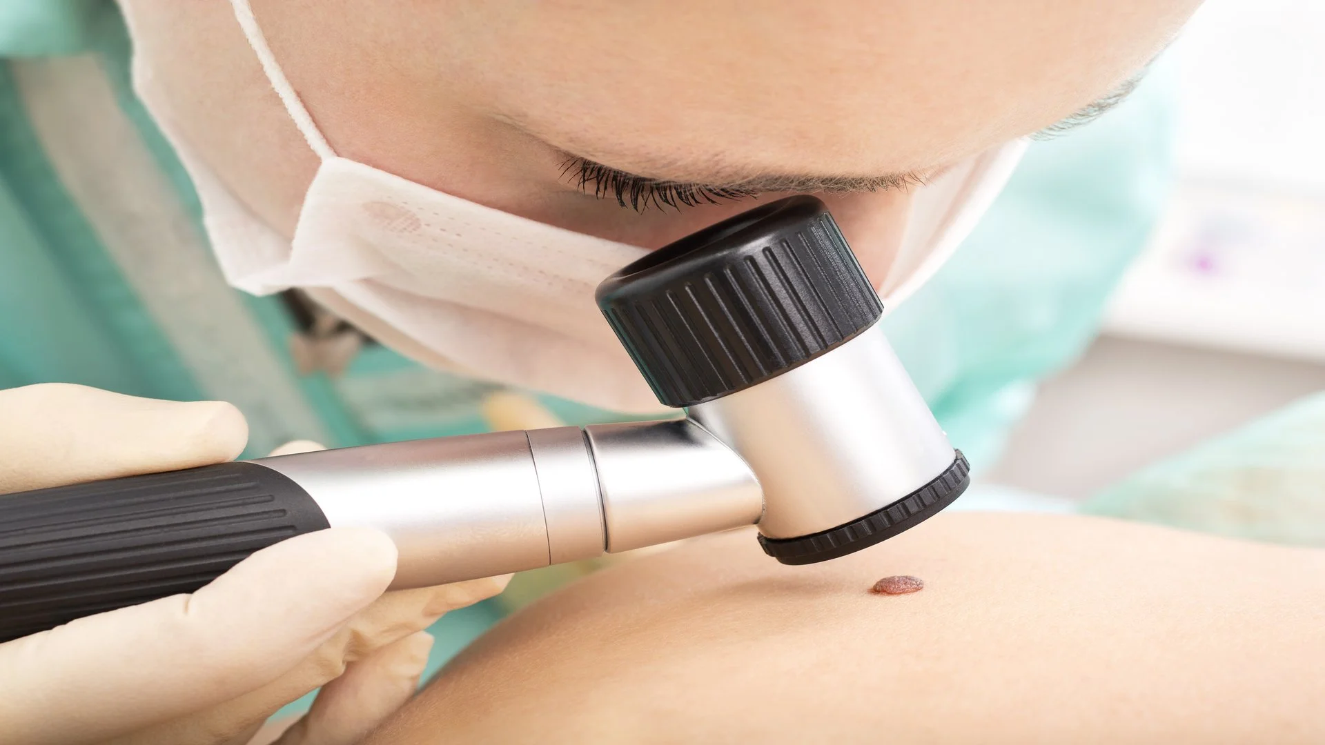 Skin Cancer Screening