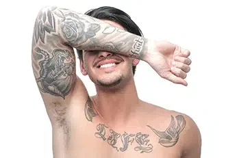 Tattoo Removal
