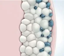 coolsculpting 3 CoolSculpting 3