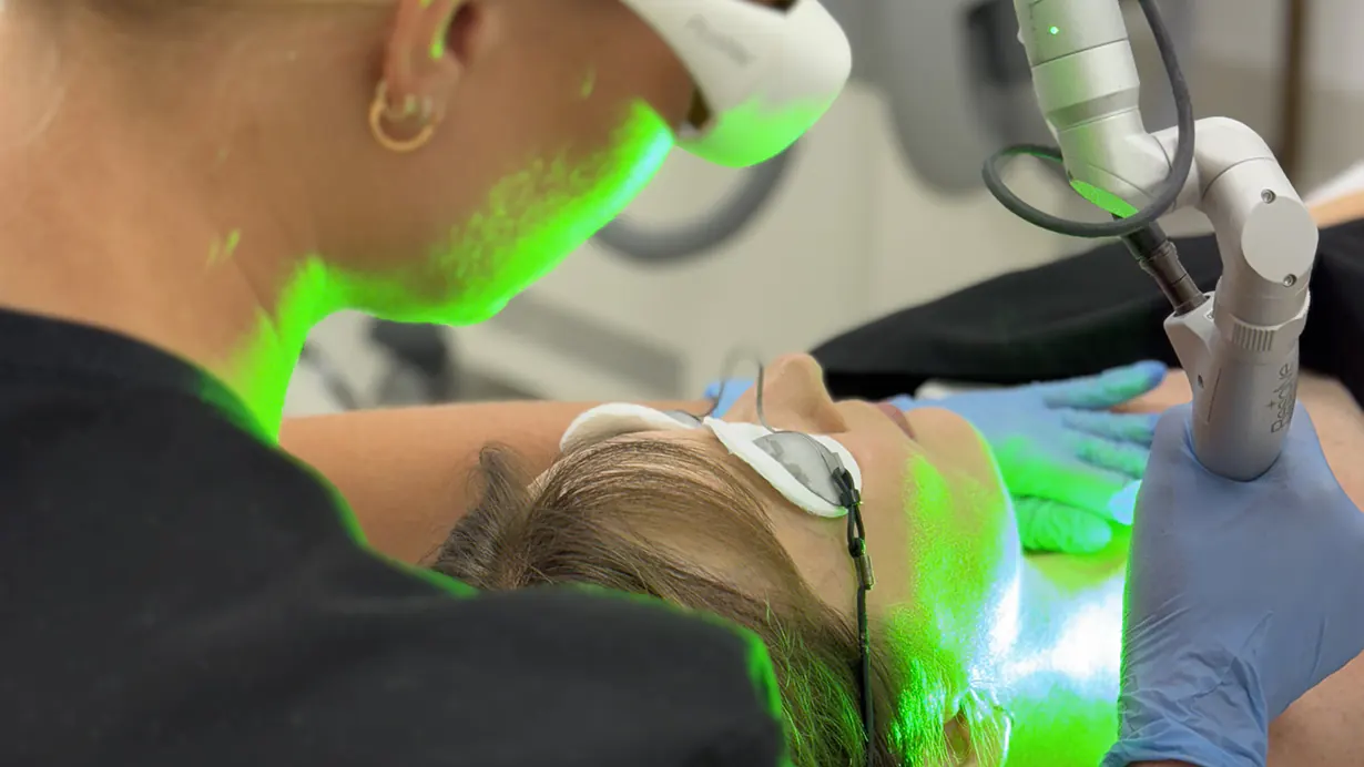 laser pigmentation removal gold coast laser pigmentation removal gold coast