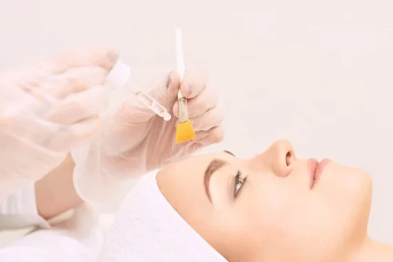 chemical-peel-gold-coast