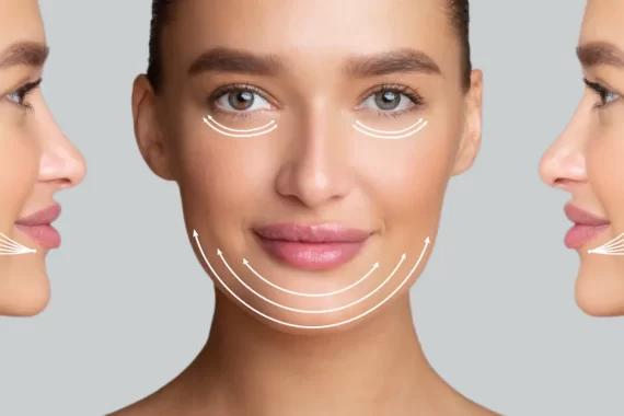 thread-lift-gold-coast