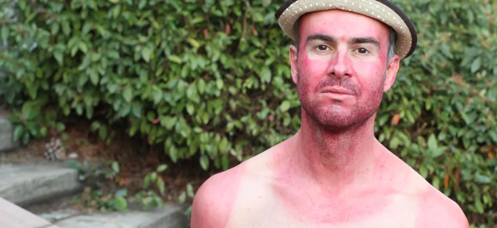 men-skin-cancer-check