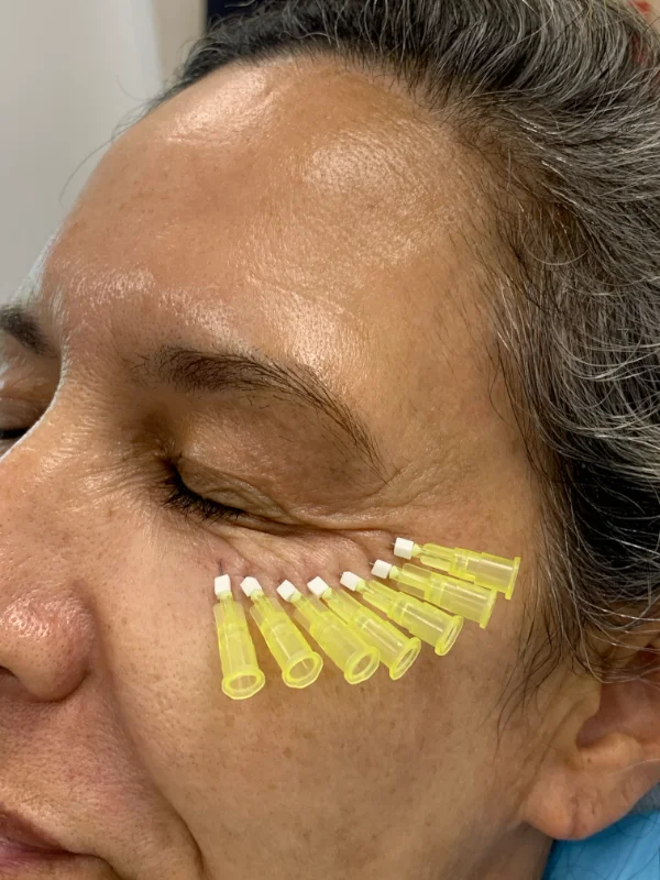 mint pdo threads gold coast