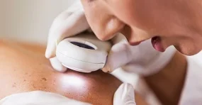 Skin-Cancer-Clinic-Robina Skin Cancer Clinic Robina