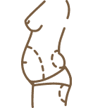 Gold Coast CoolSculpting