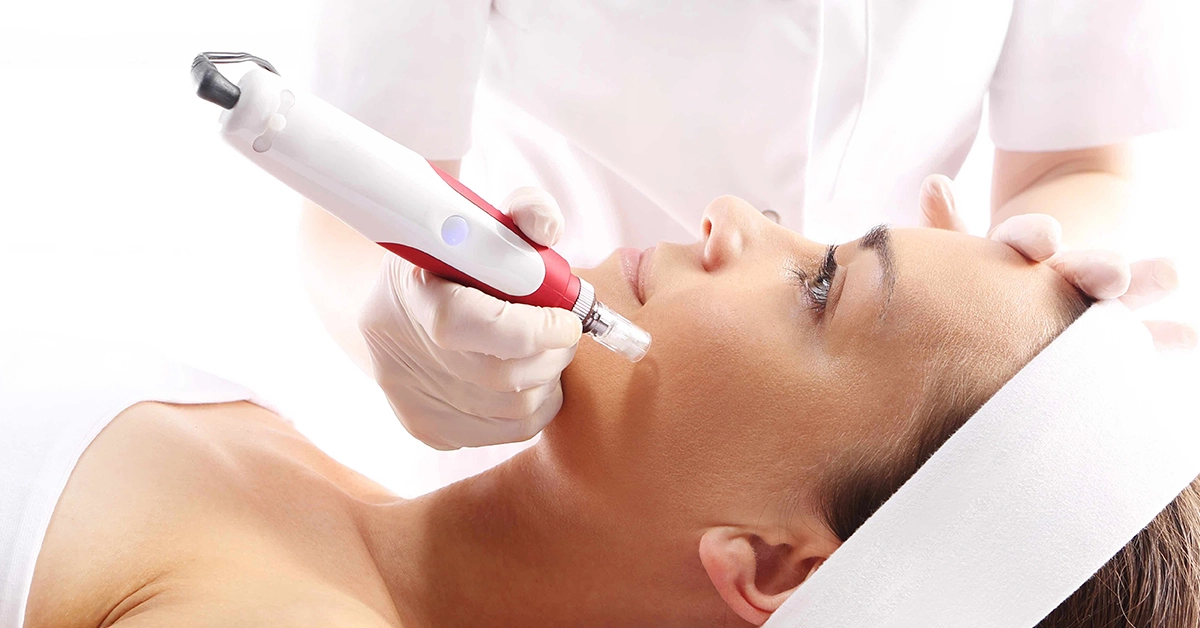 Microneedling