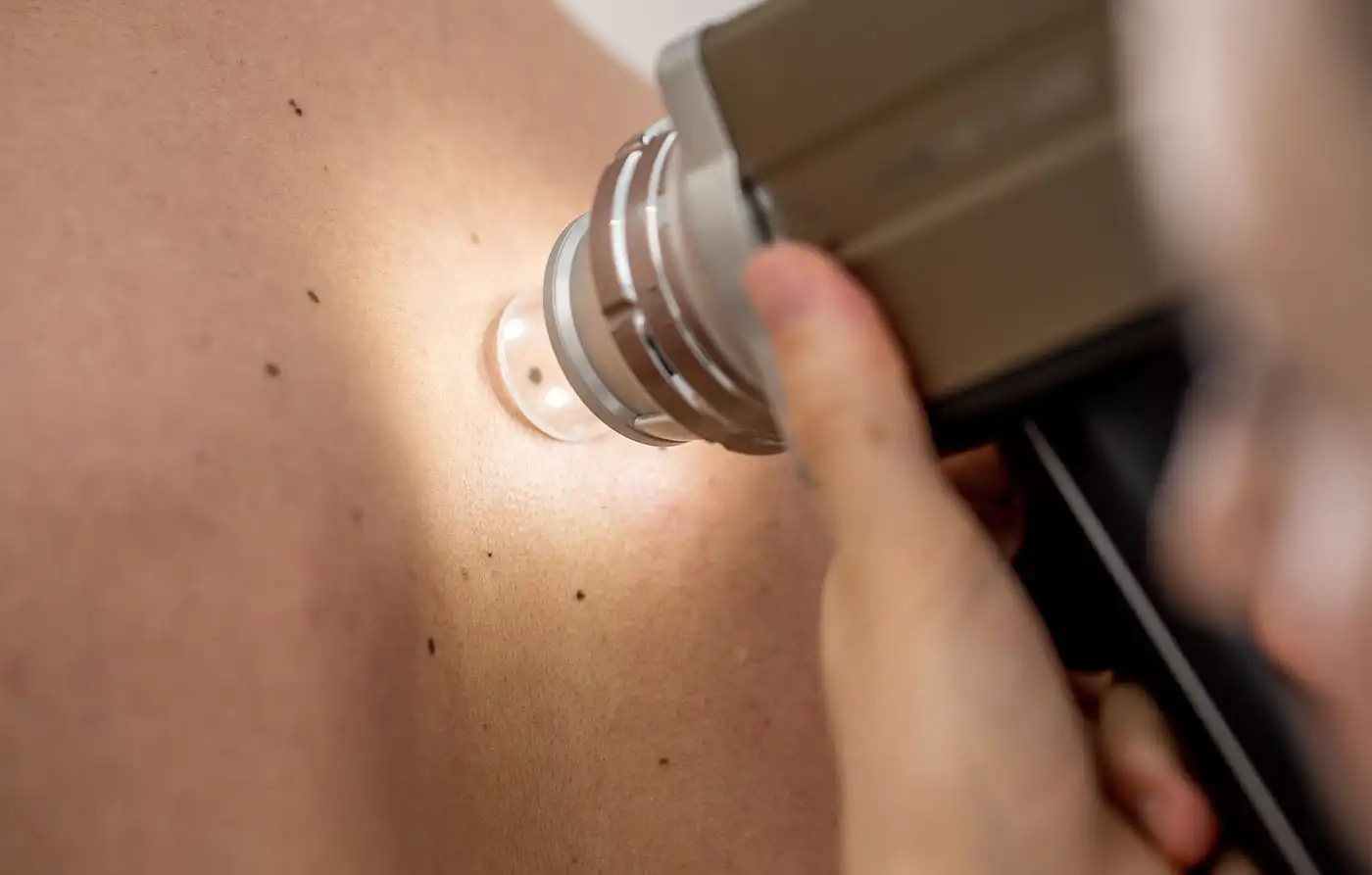 Mole Mapping & Scans