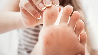 wart removal gold coast