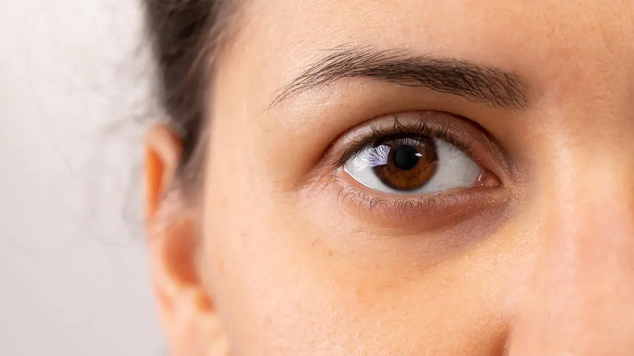 dark circles under eyes treatment gold coast