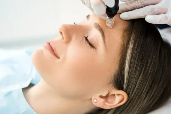 skin needling benefits