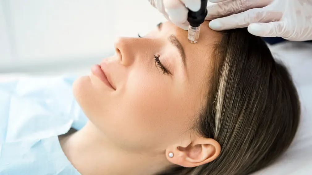 skin needling benefits